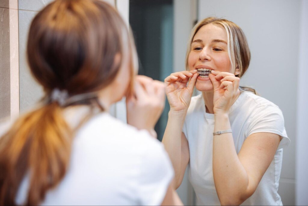 Clear Aligners